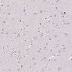 Immunohistochemical staining of human cerebral cortex shows no positivity in neuronal cells as expected.
