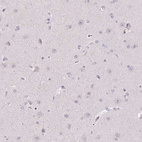 Anti-TMEM52B Antibody