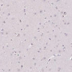 Immunohistochemical staining of human cerebral cortex shows no positivity in neuronal cells as expected.