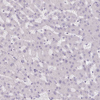 Immunohistochemical staining of human liver shows no positivity in hepatocytes as expected.