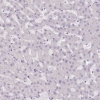Immunohistochemical staining of human liver shows no positivity in hepatocytes as expected.