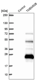 Western blot analysis in control (vector only transfected HEK293T lysate) and TMEM52B over-expression lysate (Co-expressed with a C-terminal myc-DDK tag (~3.1 kDa) in mammalian HEK293T cells, LY407200).