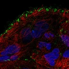 Immunofluorescent staining of human cell line CACO-2 shows localization to focal adhesion sites.