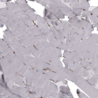 Immunohistochemical staining of human skeletal muscle shows no positivity in myocytes as expected.