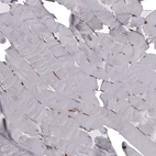 Immunohistochemical staining of human skeletal muscle shows no positivity in myocytes as expected.