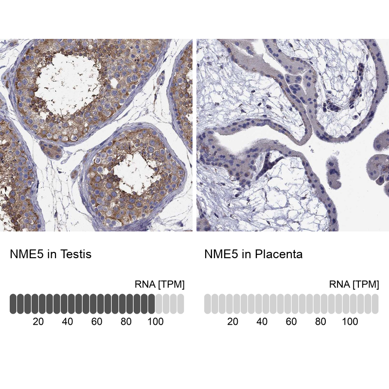 Anti-NME5 Antibody