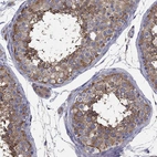 Immunohistochemical staining of human testis shows high expression.