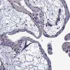 Immunohistochemical staining of human placenta shows low expression as expected.