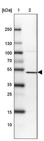 Lane 1: Marker [kDa] 250, 130, 100, 70, 55, 35, 25, 15, 10_br/_Lane 2: Human cell line U-87 MG