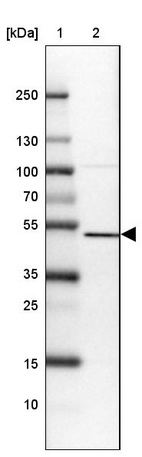 Anti-SETD7 Antibody