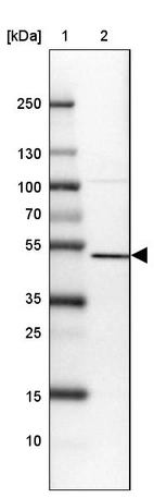 Lane 1: Marker [kDa] 250, 130, 100, 70, 55, 35, 25, 15, 10_br/_Lane 2: Human cell line U-87 MG