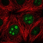 Immunofluorescent staining of human cell line MCF7 shows localization to nucleoli.