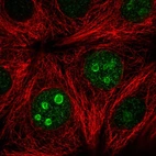 Immunofluorescent staining of human cell line MCF7 shows localization to nucleoli.
