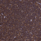 Immunohistochemical staining of human lymph node shows strong cytoplasmic positivity in non-germinal center cells.
