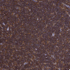 Anti-DOCK10 Antibody