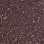 Immunohistochemical staining of human lymph node shows strong cytoplasmic positivity in non-germinal center cells.