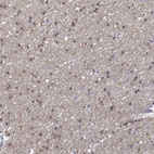 Anti-DOCK10 Antibody