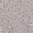 Immunohistochemical staining of human cerebral cortex shows moderate cytoplasmic positivity in glial cells.