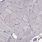 Immunohistochemical staining of human skeletal muscle shows no positivity in myocytes as expected.
