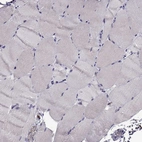 Immunohistochemical staining of human skeletal muscle shows no positivity in myocytes as expected.