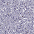 Immunohistochemical staining of human pancreas shows no positivity in exocrine glandular cells as expected.