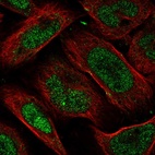 Anti-FAM193B Antibody