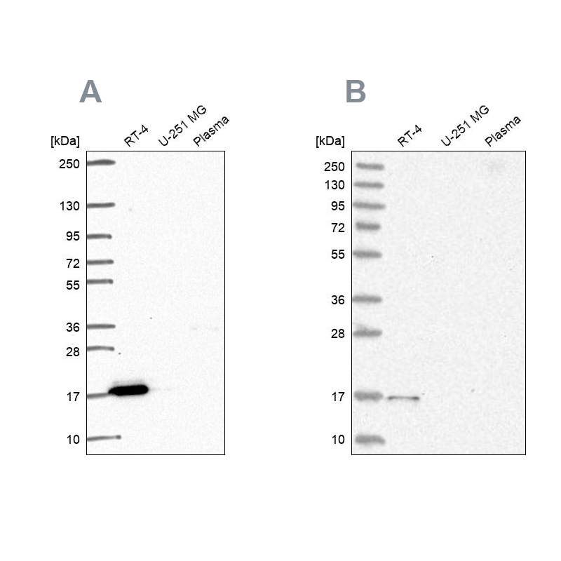 Anti-FAM162A Antibody