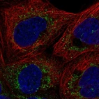 Immunofluorescent staining of human cell line A-431 shows localization to mitochondria.