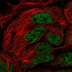 Immunofluorescent staining of human cell line CACO-2 shows localization to nucleoplasm.
