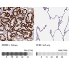 Anti-CHDH Antibody