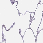 Immunohistochemical staining of human lung shows low expression as expected.