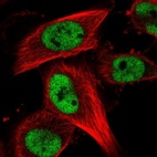 Anti-RBM15B Antibody