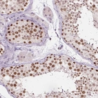 Immunohistochemical staining of human testis shows high expression.