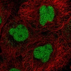 Immunofluorescent staining of human cell line A-431 shows localization to nucleoplasm & cytosol.