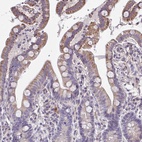 Anti-CEP63 Antibody