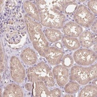 Anti-C10orf128 Antibody