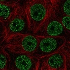 Immunofluorescent staining of human cell line MCF7 shows localization to nucleoplasm.