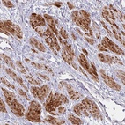 Anti-MOCS1 Antibody