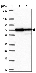 Lane 1: Marker [kDa] 250, 130, 95, 72, 55, 36, 28, 17, 10_br/_Lane 2: Human cell line RT-4_br/_Lane 3: Human cell line U-251 MG