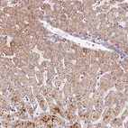 Anti-C6orf222 Antibody