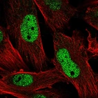Immunofluorescent staining of human cell line U-251 MG shows localization to nucleoplasm.