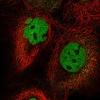 Immunofluorescent staining of human cell line A-431 shows localization to nucleoplasm.