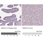 Anti-DNAH12 Antibody