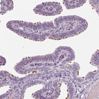 Anti-DNAH12 Antibody