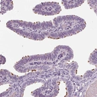 Immunohistochemical staining of human fallopian tube shows moderate positivity in ciliated cells.