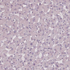 Immunohistochemical staining of human liver shows no positivity in hepatocytes as expected.