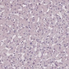 Immunohistochemical staining of human liver shows no positivity in hepatocytes as expected.