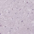 Anti-DNAH12 Antibody