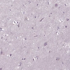 Immunohistochemical staining of human cerebral cortex shows no positivity in neurons as expected.