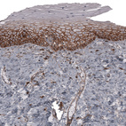 Immunohistochemical staining of human uterine cervix shows strong membranous positivity in squamous epithelial cells.